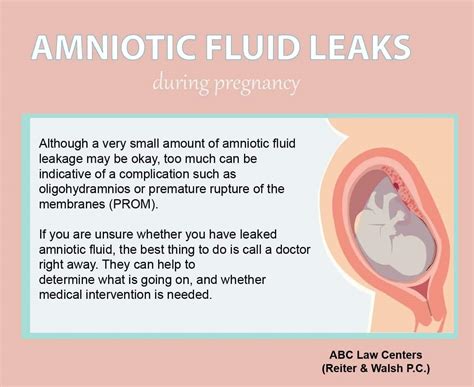 small leak of amniotic fluid|Signs Of Leaking Amniotic Fluid Vs. Discharge: The Difference